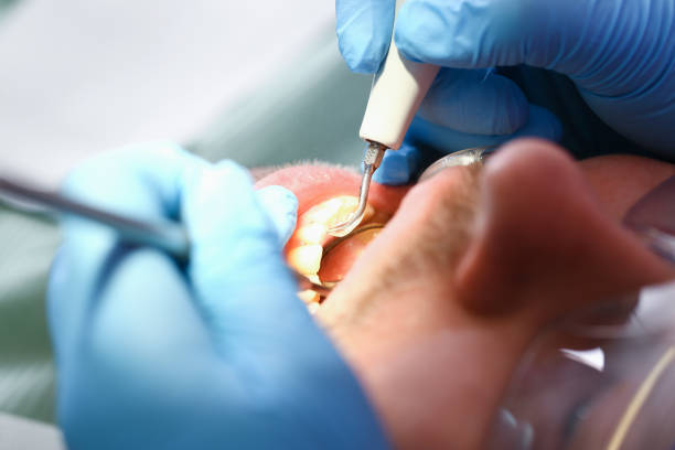 Best Urgent Tooth Repair  in Cedar Heights, MD
